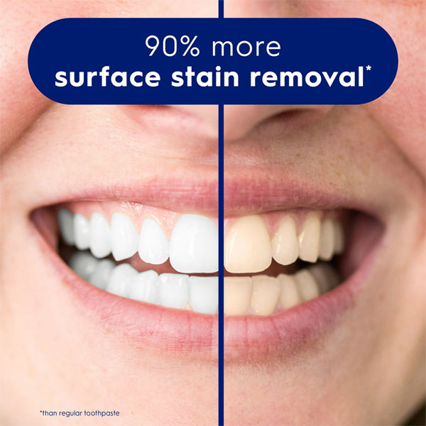 Close-up of a smiling mouth shows the left side with whiter teeth than the yellowed right, highlighting Crest 3D White Adv Deep Clean Whitening Toothpastes ability to remove up to 90% more surface stains. Shown: 3 Pack (Twin Pack, 3.3 oz) by Crest.