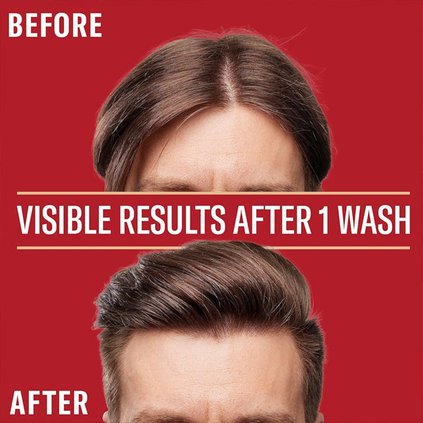 Split image of a man’s head before and after using Old Spice Pure Sport 2in1 Shampoo & Conditioner for Men (4 Pack, 22oz), featuring the text Visible Results After 1 Wash and showing fuller hair for a fresh, barbershop-quality look.