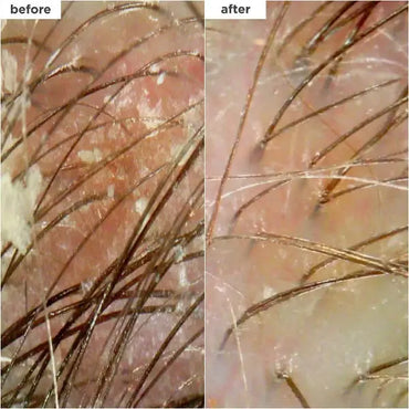 Briogeo Scalp Revival Charcoal + Coconut Oil Micro Exfoliating Scrub 8oz Briogeo