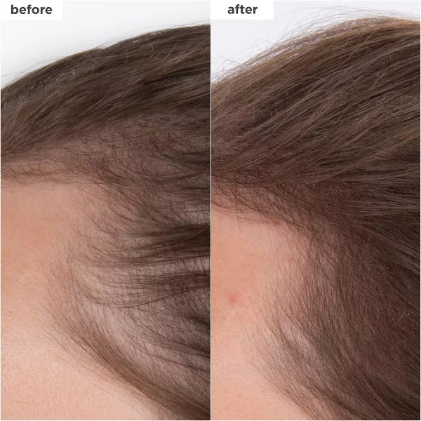 Briogeo Hair Care Destined for Density Mega Strength Density Serum 1.5oz