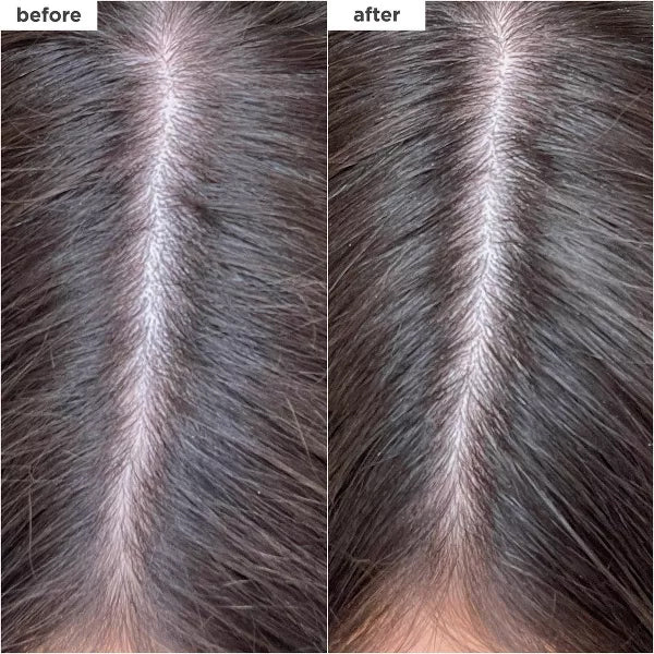 Briogeo Hair Care Scalp Revival Charcoal + Biotin Dry Shampoo 1.7oz