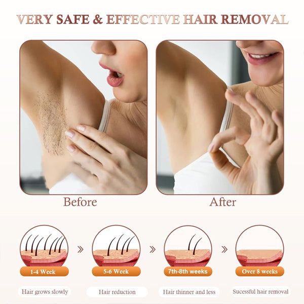 Side-by-side photos show a womans underarm before and after using the MYUPSZMI Laser Hair Removal for Women and Men, IPL Hair Removal with Ice Cold Function, plus diagrams tracking hair reduction progress over 8 weeks for salon-quality results at home.