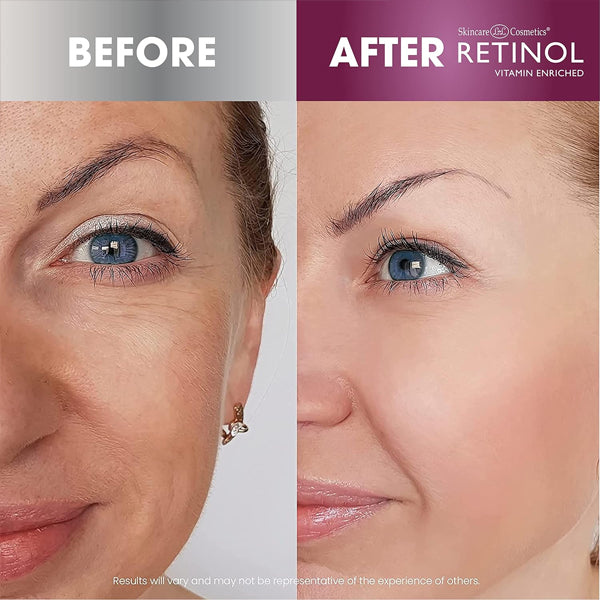 Retinol Night Cream – The Original Anti-Aging Retinol For Younger Looking Skin