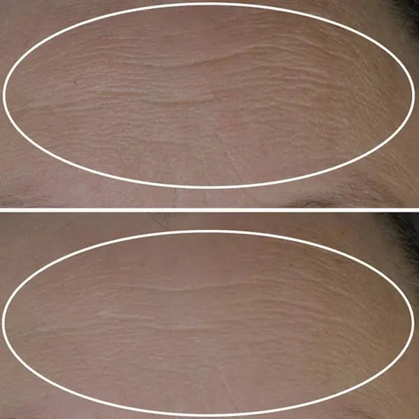 StriVectin Peptide Plump Line Filling Bounce Serum, 1oz + 0.5oz StriVectin