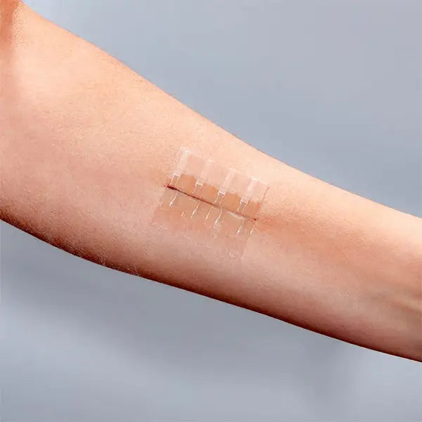 A forearm with a minor wound closed using Clozex Emergency Laceration Kit’s transparent adhesive strips—a painless alternative from Clozex for surgical skin closures.