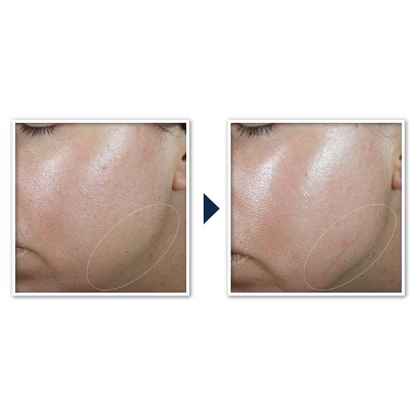 2 Pack - RoC Derm Correxion Contour Retinol Cream for Face and Neck 1.7oz RoC