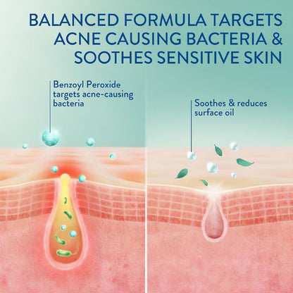 3 Pack - Cetaphil Facial Cleansers Complexion-Clearing BPO Acne Cleanser 4.2oz