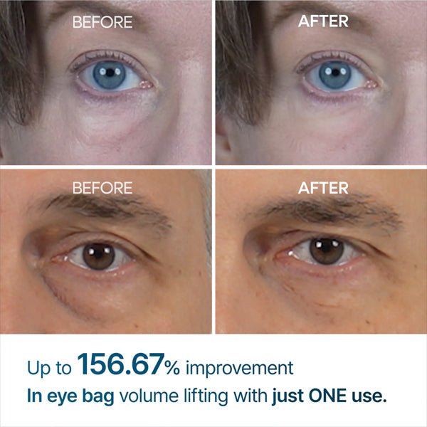 Dr. Melaxin Eyephalt Eyebag Cream Due 10g 2 Pack